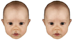 Effects on cleft lip on adults' perception of infants