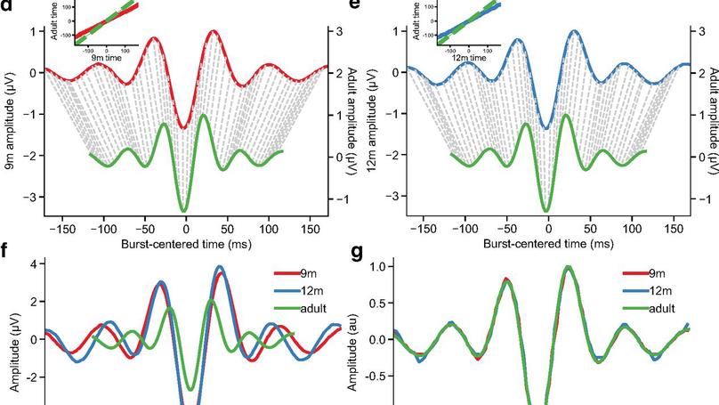 Bursting with Potential: How Sensorimotor Beta Bursts Develop from Infancy to Adulthood