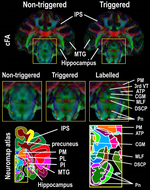 Cardiovascular effects on high-resolution 3D multi-shot diffusion MRI of the rhesus macaque brain