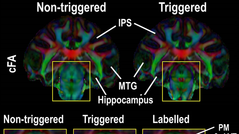 Cardiovascular effects on high-resolution 3D multi-shot diffusion MRI of the rhesus macaque brain