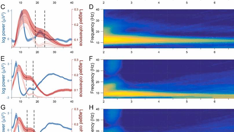 Detection and analysis of cortical beta bursts in developmental EEG data