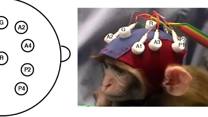 Oxytocin promotes prosocial behavior and related neural responses in infant macaques at-risk for compromised social development